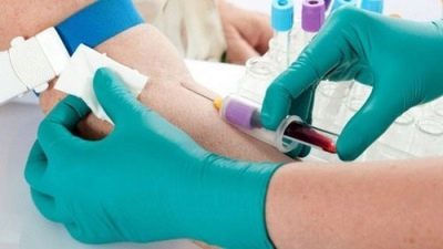 Низкие тромбоциты при беременности: пониженный уровень от нормы, как снизить