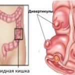 Уколы Дипроспан: инструкция по применению, цена, отзывы и аналоги