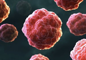 Анализ крови при лейкозе. Какие изменения в крови вызывает лейкоз. Биохимический анализ крови.