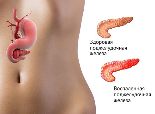 Амилаза мочи: норма и превышение допустимых показателей