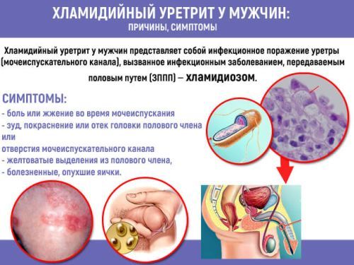 Жжение при мочеиспускании у мужчин - причины