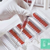 Норма СРБ в биохимическом анализе крови