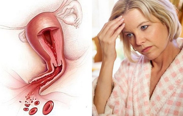 Кровоостанавливающие препараты при обильных месячных - уколы, народные средства при менструации