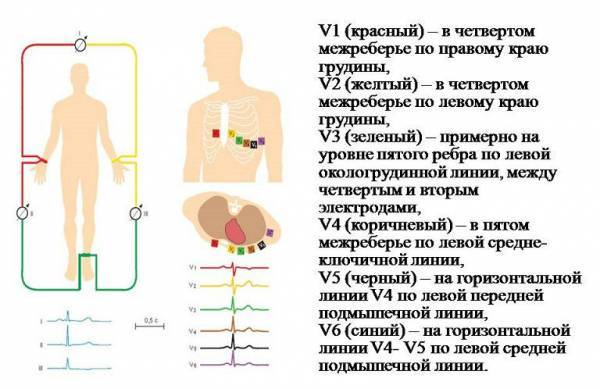ЭКГ сердца - алгоритм действия (рекомендации)