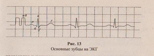 Онлайн-курс ЭКГ: ЧСС, способы ее подсчета