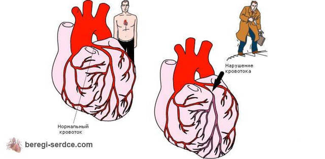Почему болит где сердце – причины и возможные заболевания