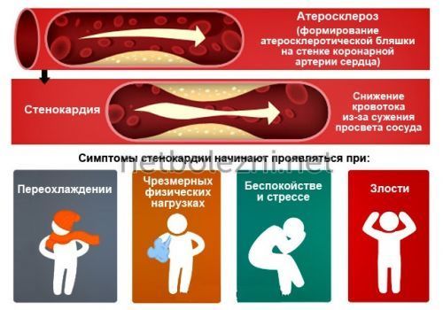 Болит и колит сердце при вдохе: причины, что делать?