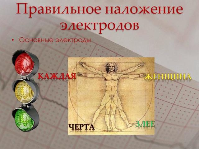 ЭКГ сердца - алгоритм действия (рекомендации)
