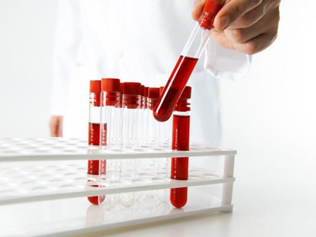 Что такое АЛТ в биохимическом анализе крови