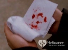 Жужжащее дыхание кровохарканье. Кровохарканье — Причины, Неотложная помощь