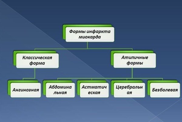 Классификация инфаркта миокарда: основные виды, формы и стадии