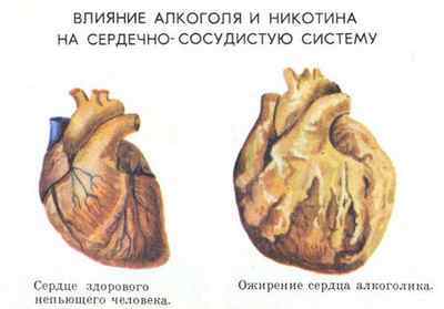 Перестает болеть сердце после алкоголя. Что нужно делать при сердечных болях после алкоголя. После алкоголя болит сердце? Возможные причины и методы лечения
