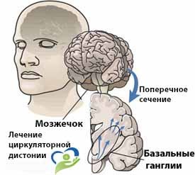Нейроциркуляторная дистония: что это такое, причины, симптомы, лечение