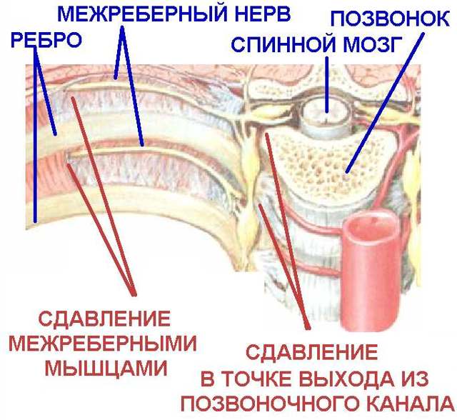Боль в грудине посередине при вдохе, при нажатии, при движении – причины