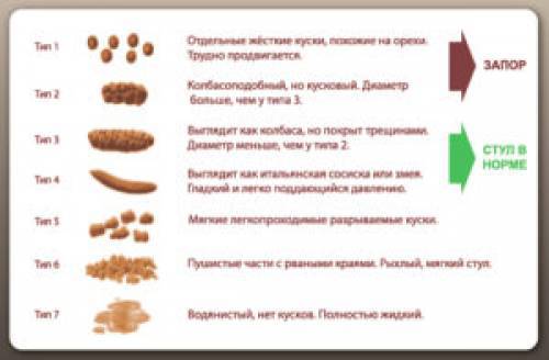 Виды кала. Бристольская шкала формы кала
