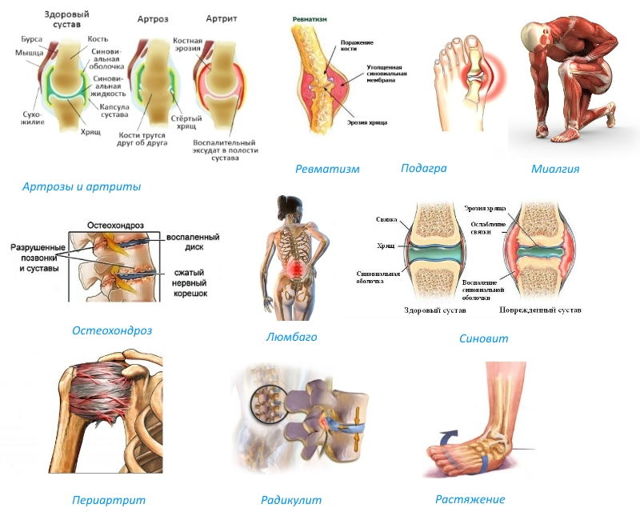 Ортофен мазь: инструкция по применению, состав, цена