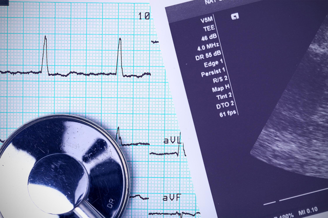 Причины, симптомы и лечение тахикардии при беременности
