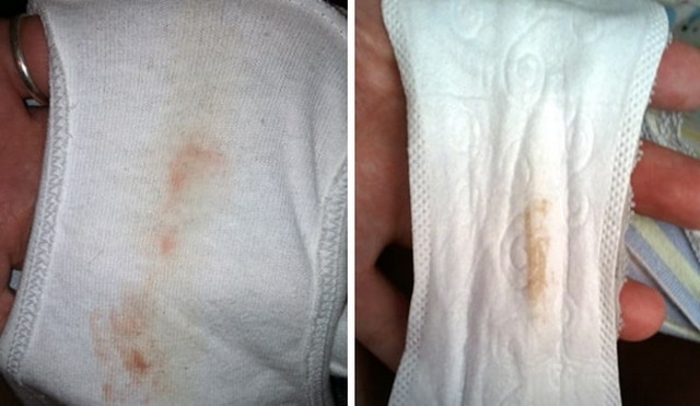 Имплантационное кровотечение - Лечение кровотечений