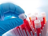 Исследование сосудистой системы гемостаза - Семейный доктор