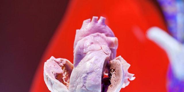 От чего происходит инфаркт миокарда