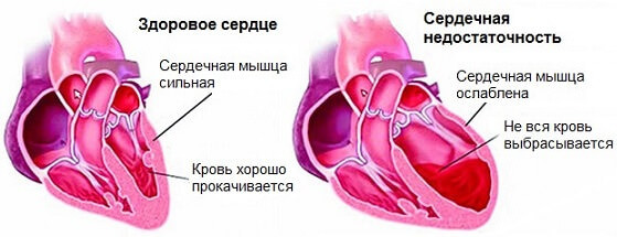 Скачет давление (то низкое, то высокое): что делать, причины, признаки