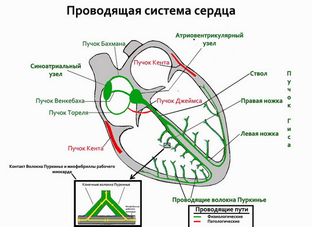 Нарушения сердечного ритма и проводимости - Хиликон