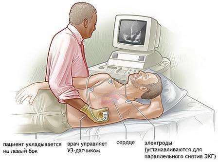 В области сердца тяжесть: причины и симптомы