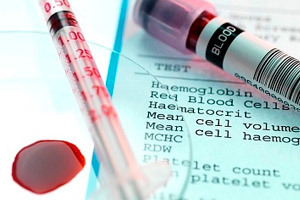 Повышенный гемоглобин в анализе крови - что означает, признаки, лечение и последствия