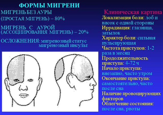 Лечение мигрени: препараты, методы и первая помощь