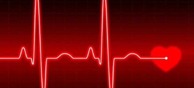 Регулярный и нерегулярный синусовый ритм сердца