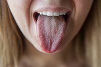Белый налет на языке у ребенка - причины и способы лечения