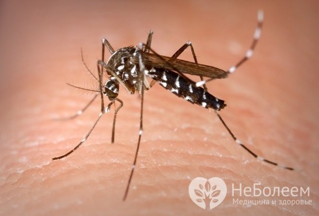 Вирус Зика - причины, симптомы и лечение Zika virus