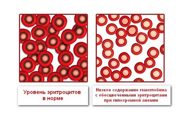 Норма эритроцитов в крови: что такое красные клетки, за что они отвечают и как обозначаются в анализе, количеству у женщин и мужчин, изменения по возрасту