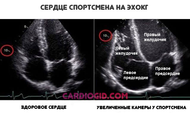 Пульс 95 в покое причины - Все про гипертонию