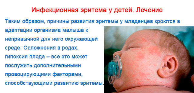 Эритема у детей и взрослых: симптомы, фото, лечение