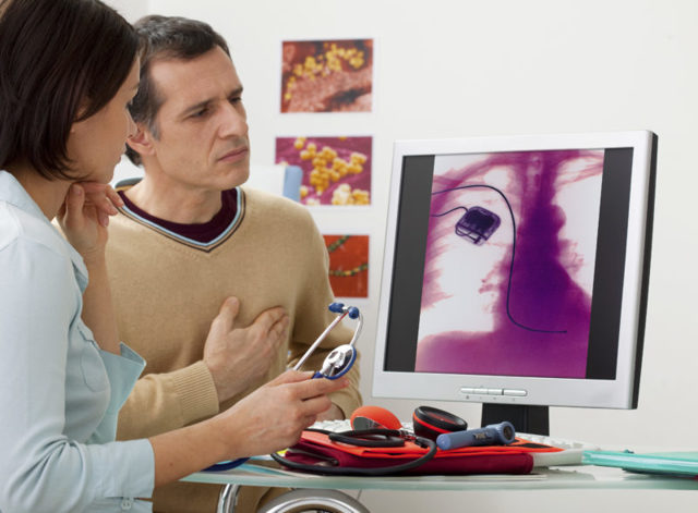 Как курение влияет на сердце человека: тахикардия, пульс, мерцательная аритмия