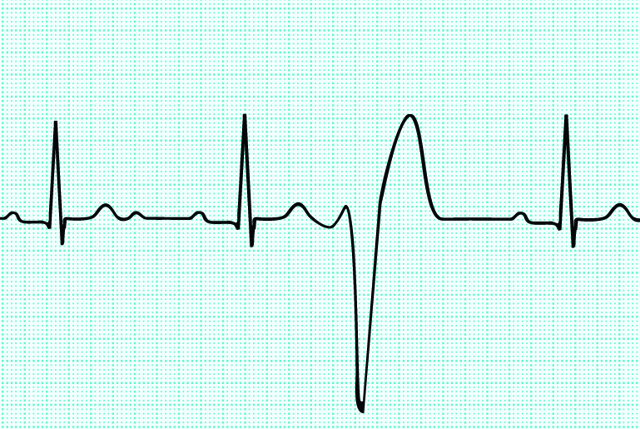 Перестает болеть сердце после алкоголя. Что нужно делать при сердечных болях после алкоголя. После алкоголя болит сердце? Возможные причины и методы лечения