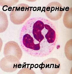 Нейтрофилы понижены в крови у ребенка или взрослого - причины, лечение и степени нейтропении