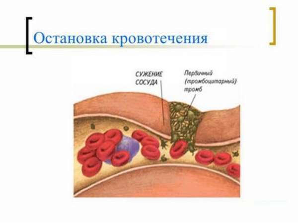 Повышенная свертываемость крови при беременности