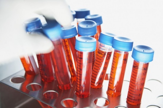 Нормы сахара в крови у взрослых: показатели, отклонения