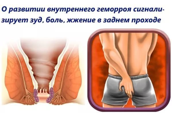 Кровь из прямой кишки: на что стоит обратить внимание