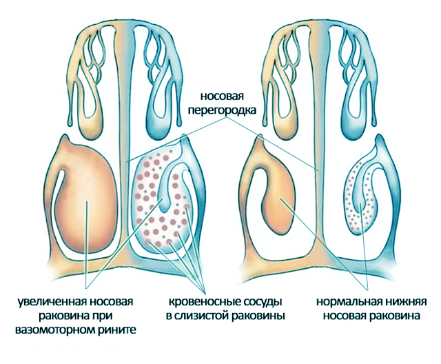 Флеминга мазь цена, Флеминга мазь купить, инструкция по применению, аналоги в Лаборатории Красоты и Здоровья
