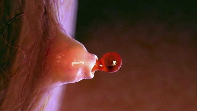 Небольшие кровянистые выделения после месячных - Всё о гинекологии