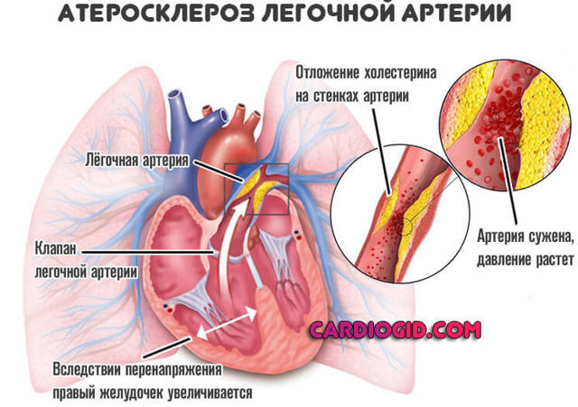 УКРЕПЛЕНИЕ СЕРДЕЧНОЙ МЫШЦЫ. СЕРДЦЕ ПИТАНИЕ ПРОФИЛАКТИКА ПРОДУКТЫ СРЕДСТВА ВИТАМИНЫ