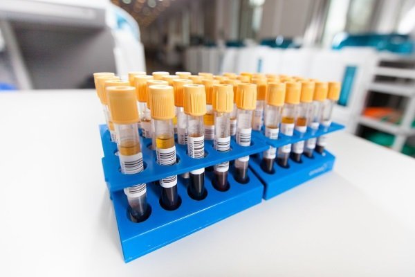 4. Правила взятия, хранения и транспортировки биоматериала