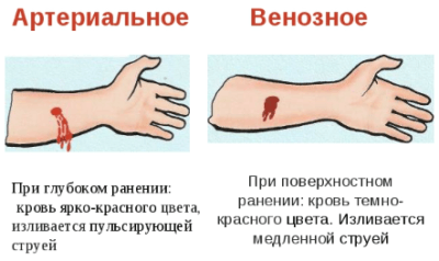 Венозная кровь человека в отличие от артериальной. Отличия венозной и артериальной крови