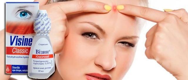 Визин - 37 отзывов, цена от 78 руб., инструкция по применению