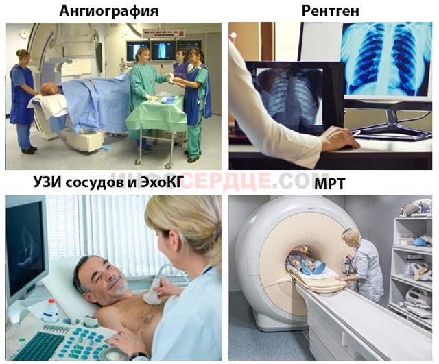 Аорта уплотнена - что это значит? Лечение уплотнения аорты