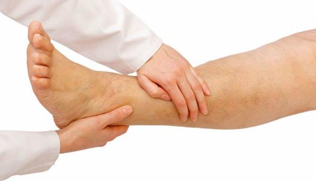 Венотоники при варикозе ног - гель, уколы, отзывы