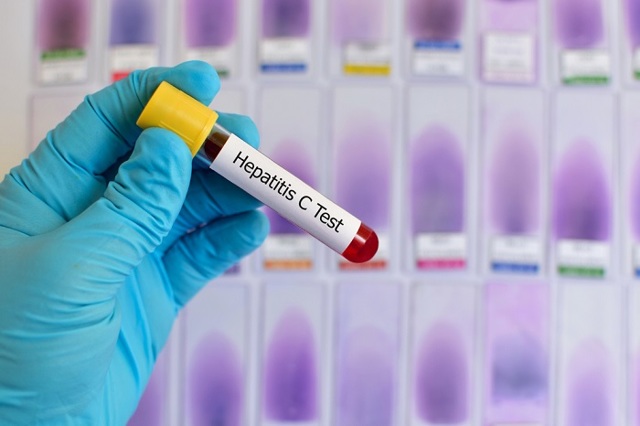 Anti hcv подтверждающий положительный что это значит — Лечим печень